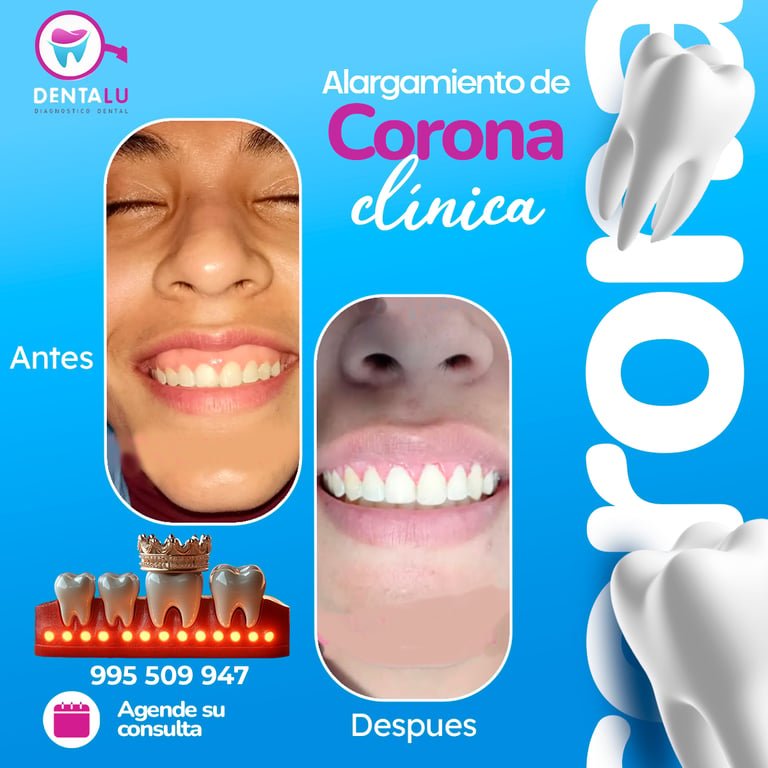 Proyecto marketing clínico Final Agosto Dentalu